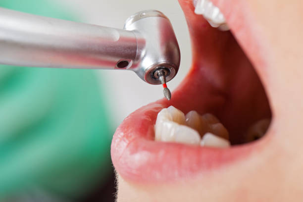 Best Emergency Gum Treatment in Pilot Mountain, NC